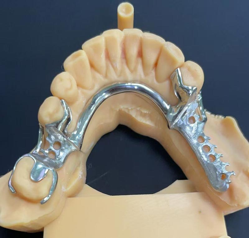 Переваги каркаса Cobalt-Chromium (Co Cr Framework)