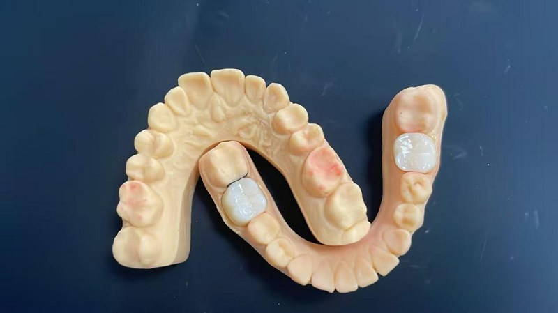 Що таке плечовий край?