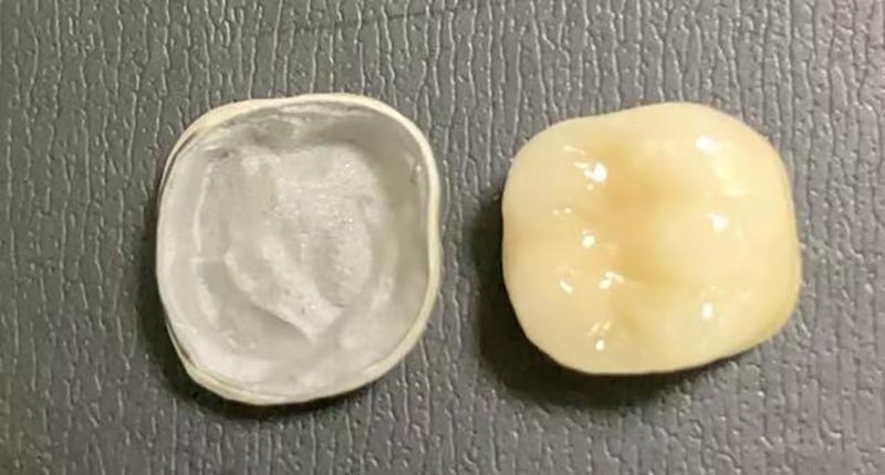 WM DENTAL LAB – провідна китайська стоматологічна лабораторія