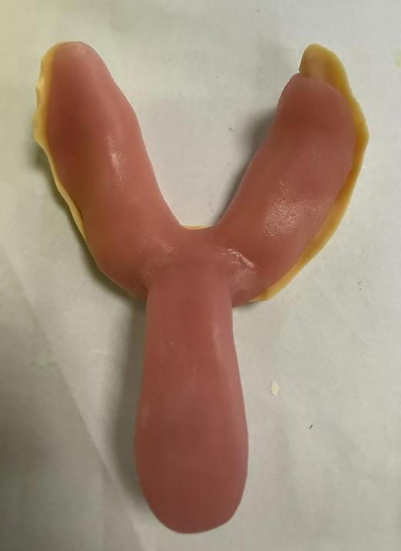 Те, чого ви не знали про індивідуальні стоматологічні лотки