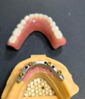 Локатор і стоматологічна планка